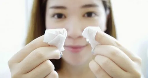 Cách nặn mụn đầu đen tại nhà