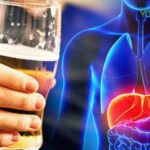 Uống bia có nổi mụn không? Cách uống không bị mọc mụn!